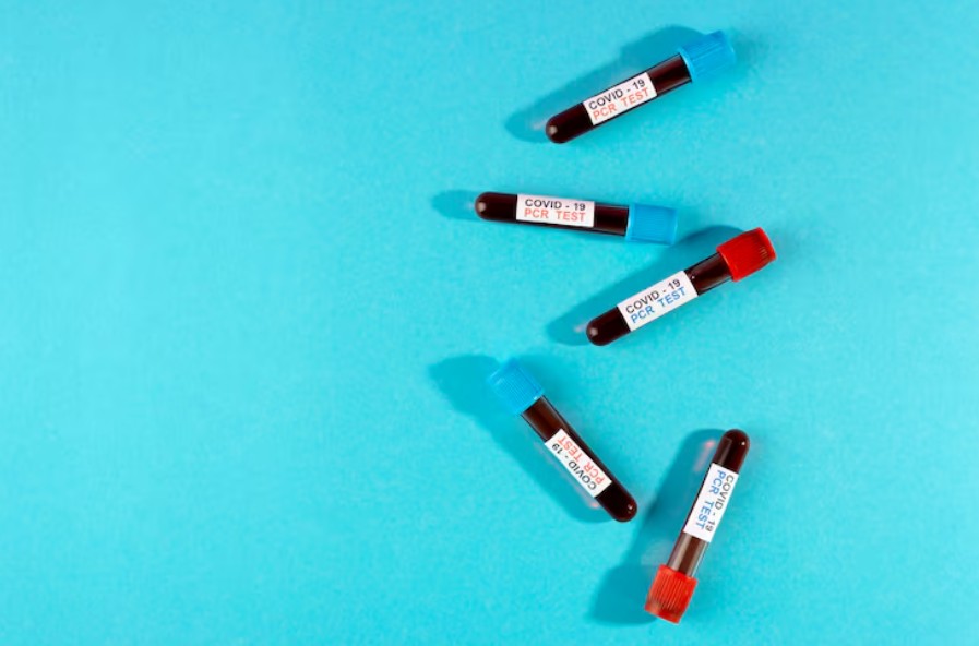 You are currently viewing C-peptide 검사 수치와 의미 췌장 기능 정밀 진단