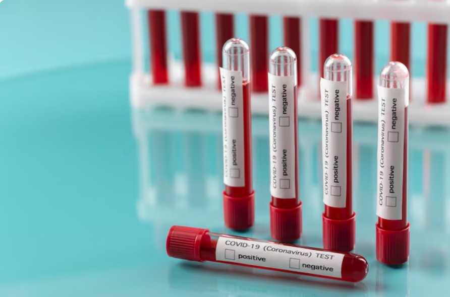 You are currently viewing 베타 HCG (β-hCG) 검사와 임신 단계별 필수 검사 가이드