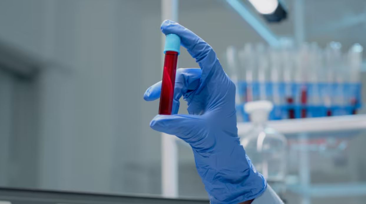 You are currently viewing LAP 검사 정상수치, 높은 이유·낮은 이유 완전 정리