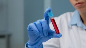 Read more about the article Insulin 검사 수치와 의미 인슐린 저항성 판단 가이드