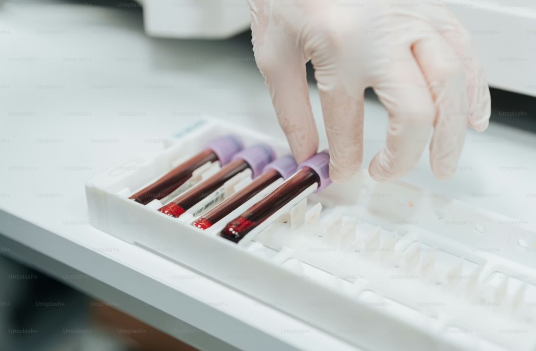 Read more about the article Potassium 검사 정상 수치, 높을 때·낮을 때 원인 및 심장 건강 관리법