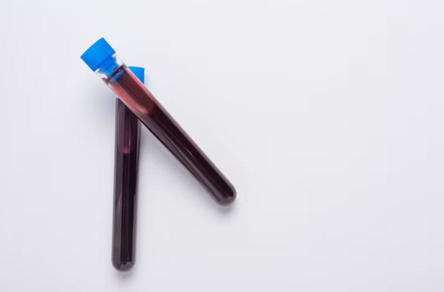 You are currently viewing HOMA-IR 인슐린 저항성 검사 수치 해석과 개선 방법