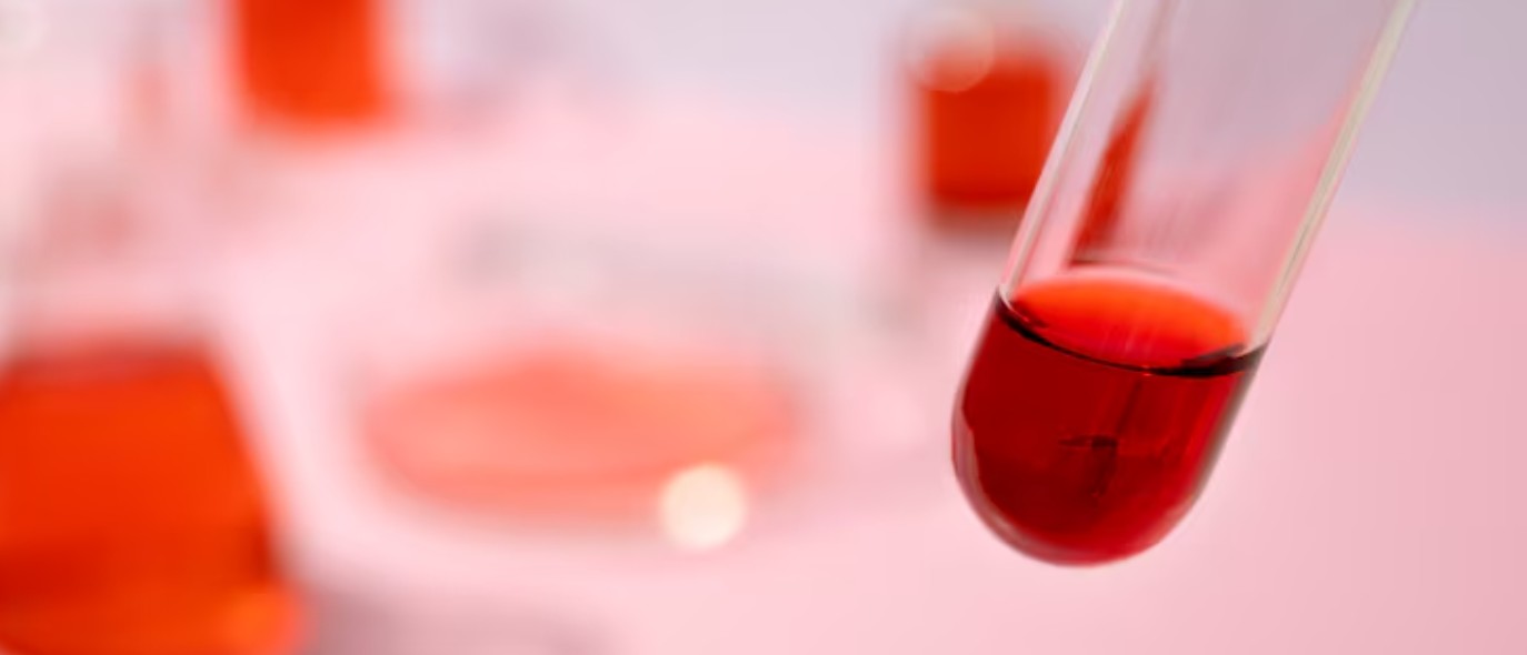 You are currently viewing TBPE 검사 수치 해석 및 위양성 주의사항 가이드