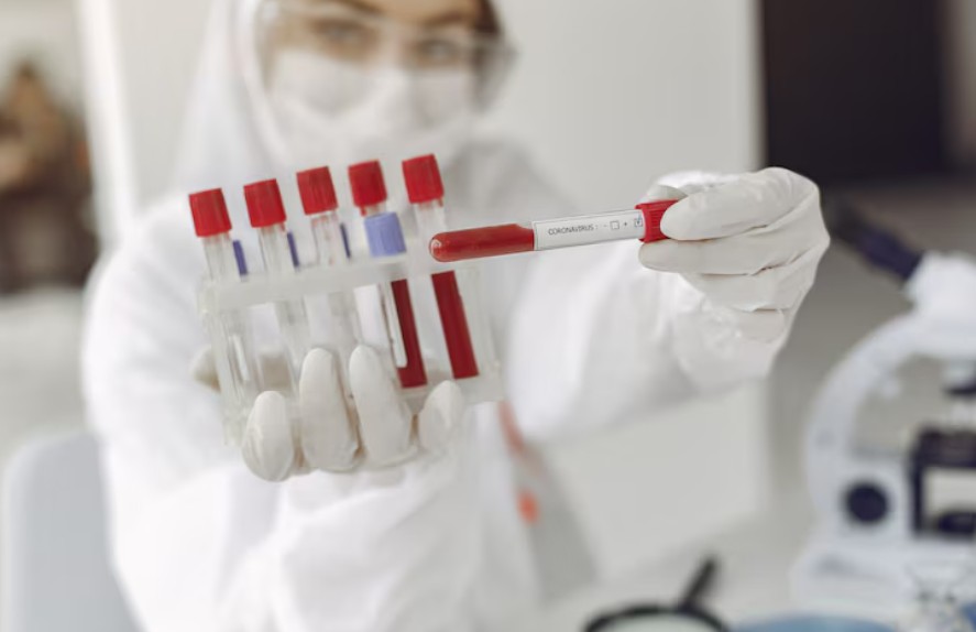 You are currently viewing Digoxin 혈중 농도 검사 해석 및 주의사항 가이드