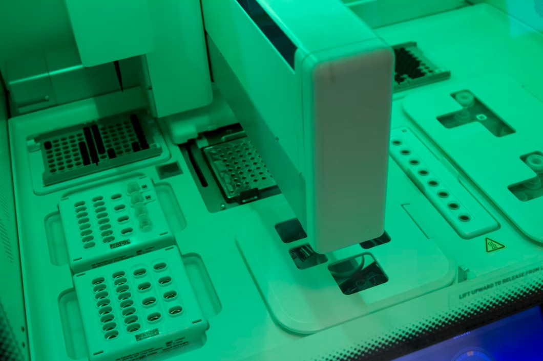 You are currently viewing Glucose 검사 결과 해석: 정상 범위와 당뇨 진단 기준, 낮추는 음식