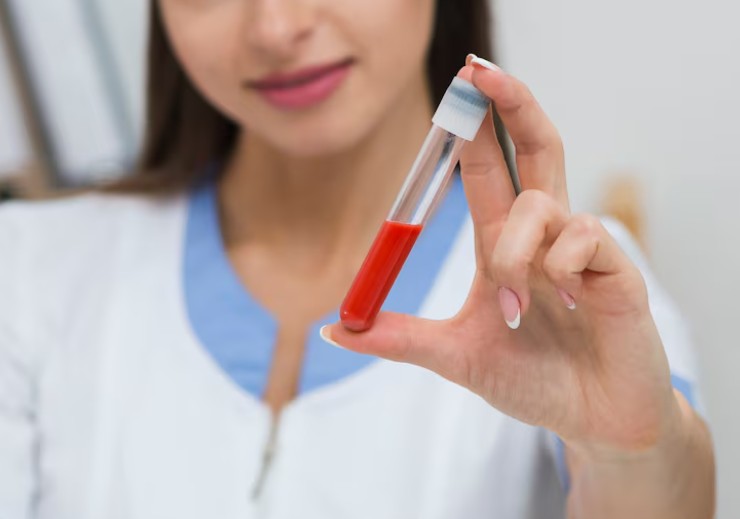 You are currently viewing HbA1c 검사 해석 높을 때와 낮을 때의 음식 및 주의사항