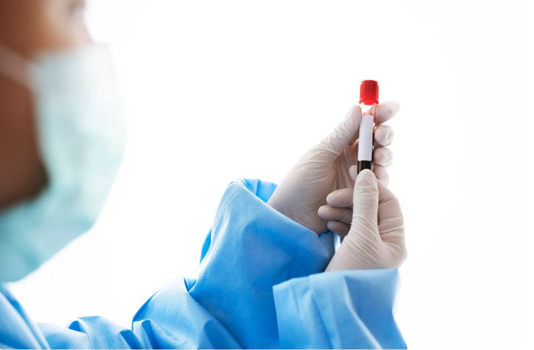 Read more about the article Total Bilirubin 수치 해석 및 간 건강 관리법