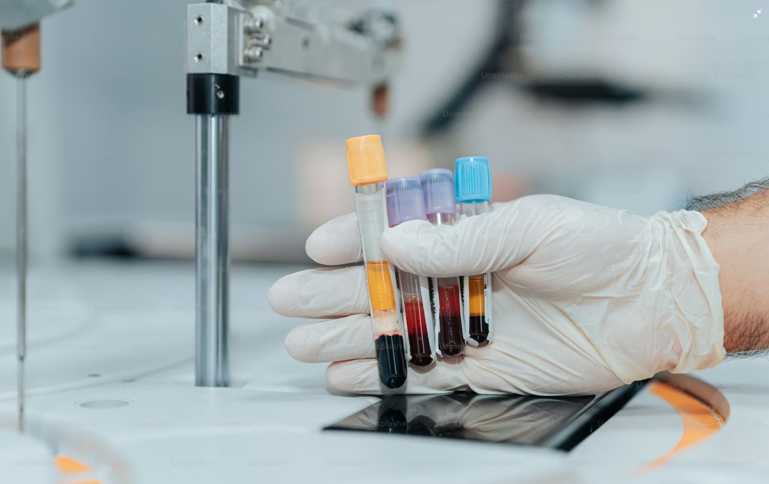 Read more about the article LDH 검사 정상수치, 높은 이유·낮은 이유 완벽 정리