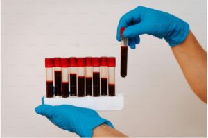 Read more about the article HIV Ag/Ab 콤보 검사 가이드: 4세대 검사 시기와 양성/음성 판독 기준