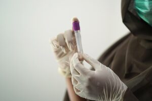 Read more about the article Anti-HEV IgG(E형 간염 항체) 검사 가이드: 감염 경로와 결과 해석