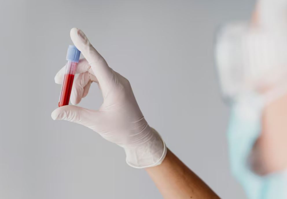 You are currently viewing HCV Genotyping(C형 간염 유전자형) 검사 완치로 가는 필수 단계