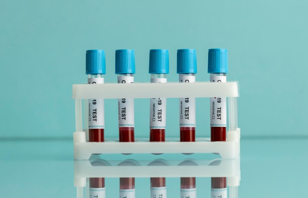 You are currently viewing Anti-HDV(D형 간염 항체) 검사 B형 간염과의 동시 감염 위험성