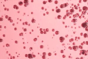 Read more about the article Reticulocyte(망상 적혈구) 수치 해석 골수 기능과 빈혈 진단 가이드