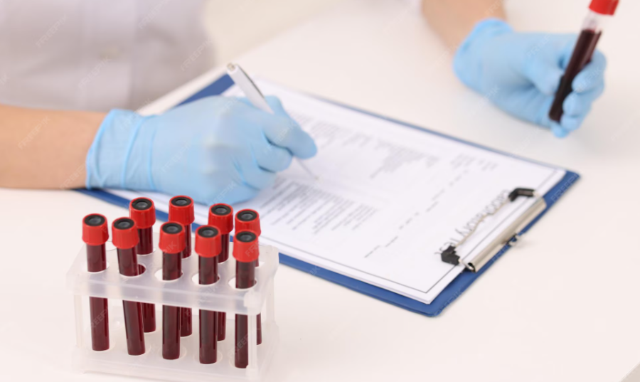 You are currently viewing FDP(섬유소 분해 산물) 검사 상승의 의미와 혈액 응고 장애 진단