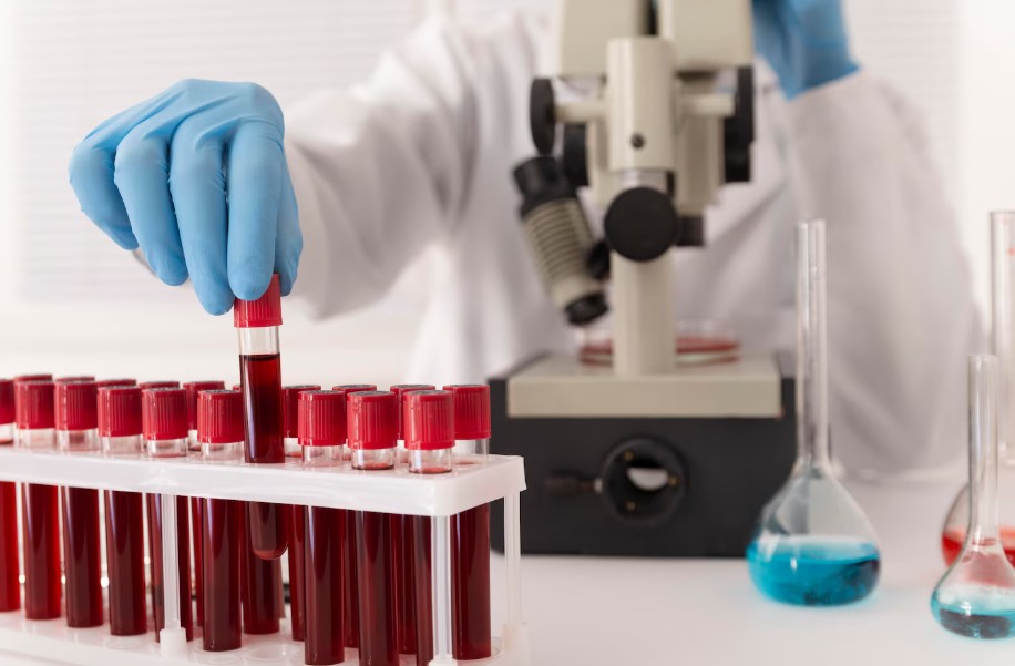 You are currently viewing Lupus Anticoagulant(LA) 검사 수치 해석과 항인지질항체 증후군 진단