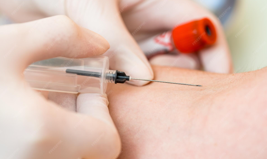 Read more about the article Antithrombin III (AT III) 검사 수치 해석과 혈전증 위험 분석