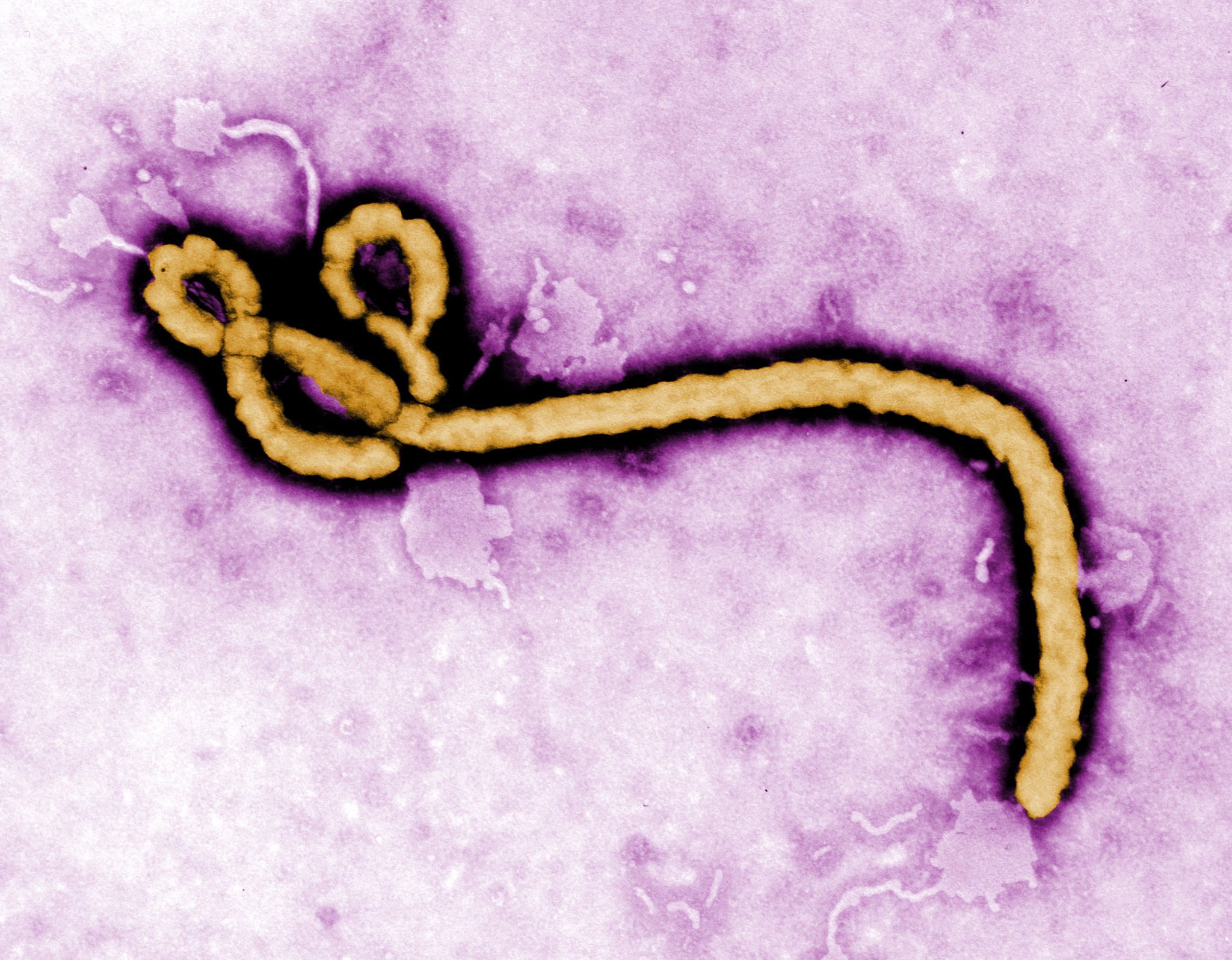 You are currently viewing Ebola virus 감염 경로, 치명적 증상, 검사법부터 완치 후 반전까지