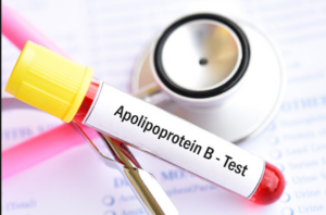 Read more about the article Apolipoprotein A-I 검사 HDL 콜레스테롤의 진짜 능력을 측정하는 척도