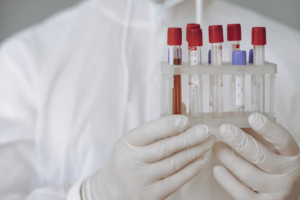 Read more about the article Ketone body (케톤체) 3분획 검사 케토아시도시스(DKA) 및 유기산 대사 정밀 진단학적 접근