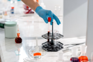 Read more about the article Anti-PR3 (C-ANCA) 검사 육아종성 다발혈관염 진단 및 정밀 해석